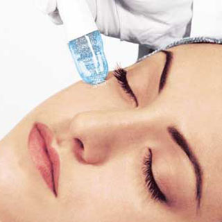 microdermoabrasión dermatologa